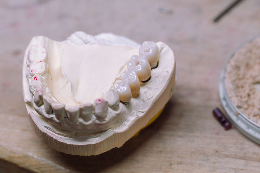 Gipsabdruck vom Gebiss Dentallabor (Axel Jahnke | Fotografie)